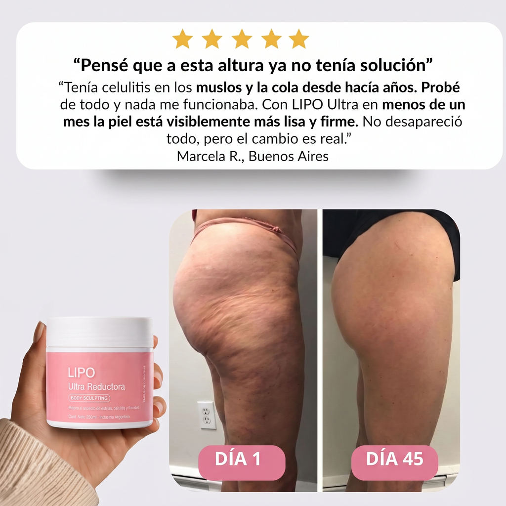 LIPO Ultra Reductora® | Emulsión anticelulitis, reafirmante y reductora